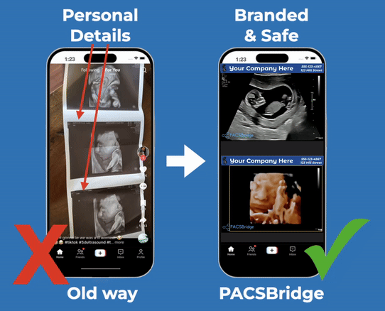 PACSBridge Demo - Before and After Comparison