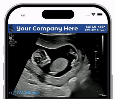PACSBridge Mobile Experience Demo